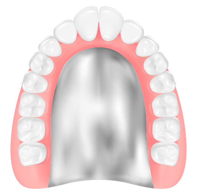 コバルトクロム・チタン床義歯